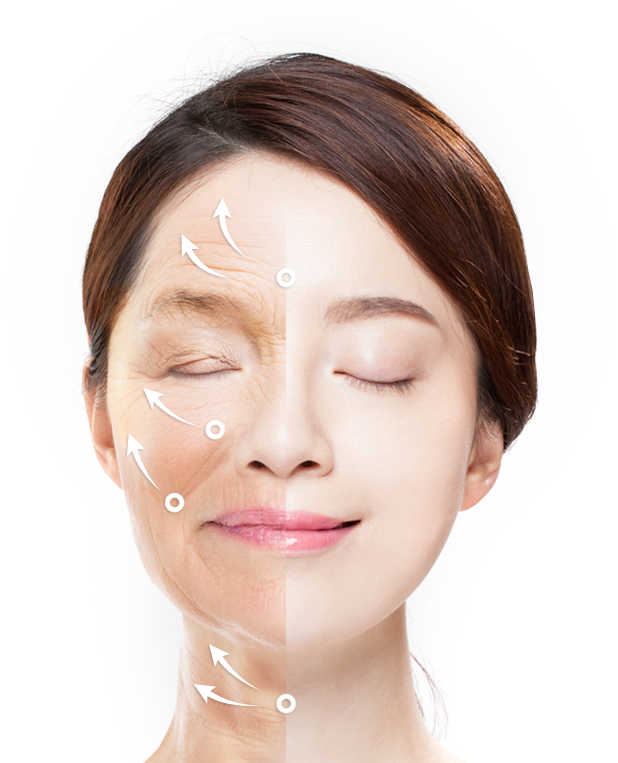 face lift korea - Face Lift