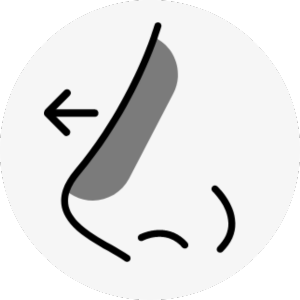 hawk nose surgery korea - Hawk Nose