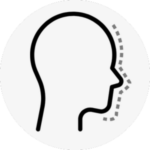 hawk nose surgery korea - Hawk Nose
