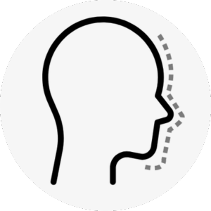 hawk nose surgery korea - Hawk Nose