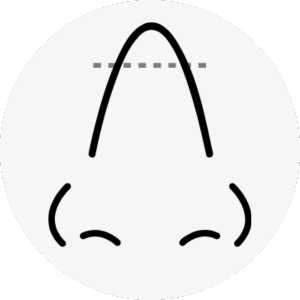 hawk nose surgery korea - Hawk Nose