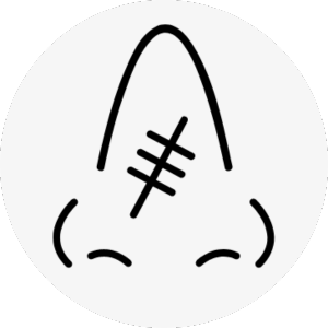 hawk nose surgery korea - Hawk Nose