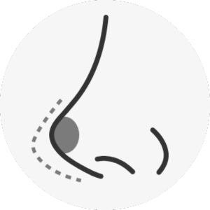 hawk nose surgery korea - Hawk Nose
