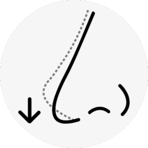 hawk nose surgery korea - Hawk Nose
