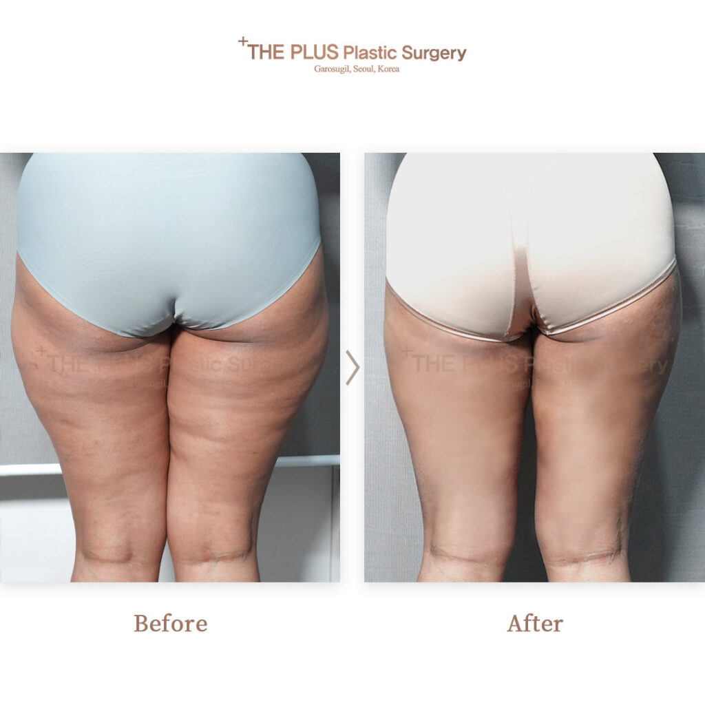 THE PLUS CLINIC KOREA -