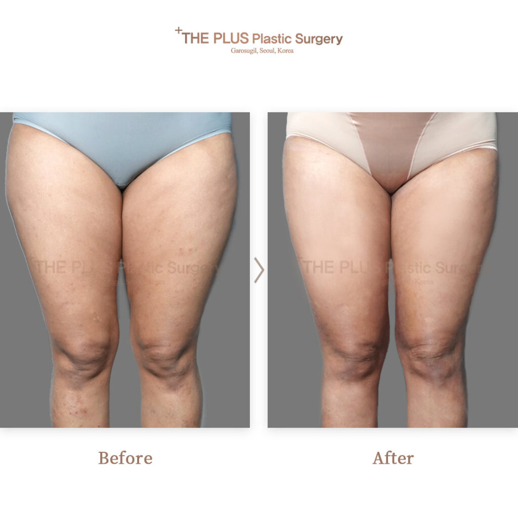 THE PLUS CLINIC KOREA -