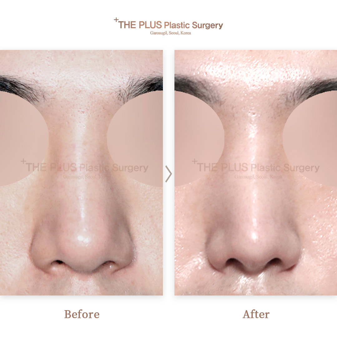 THE PLUS CLINIC KOREA -