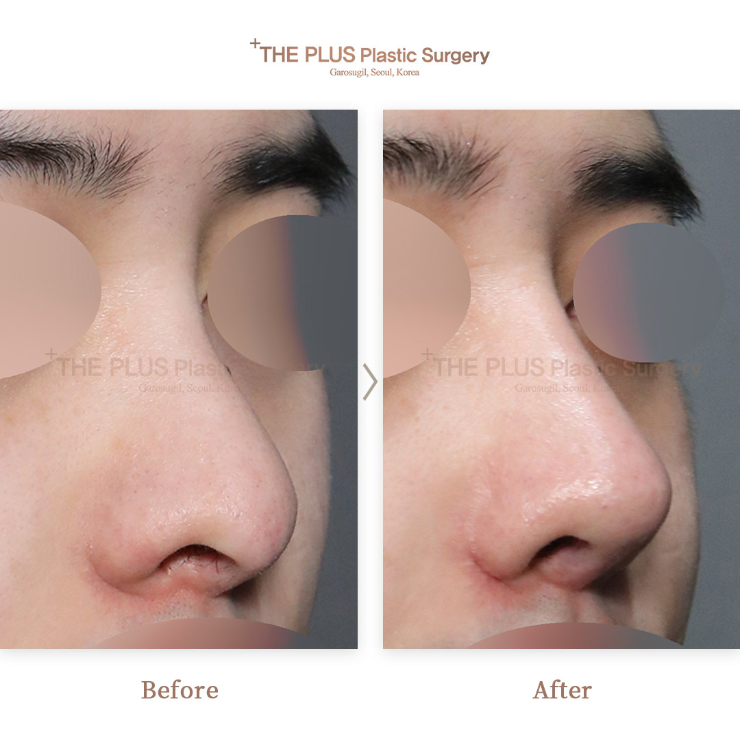 THE PLUS CLINIC KOREA -