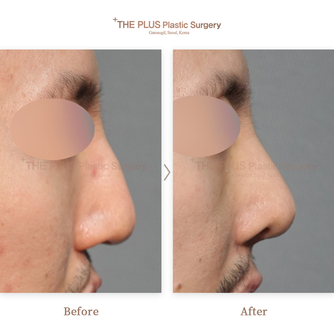 THE PLUS CLINIC KOREA -