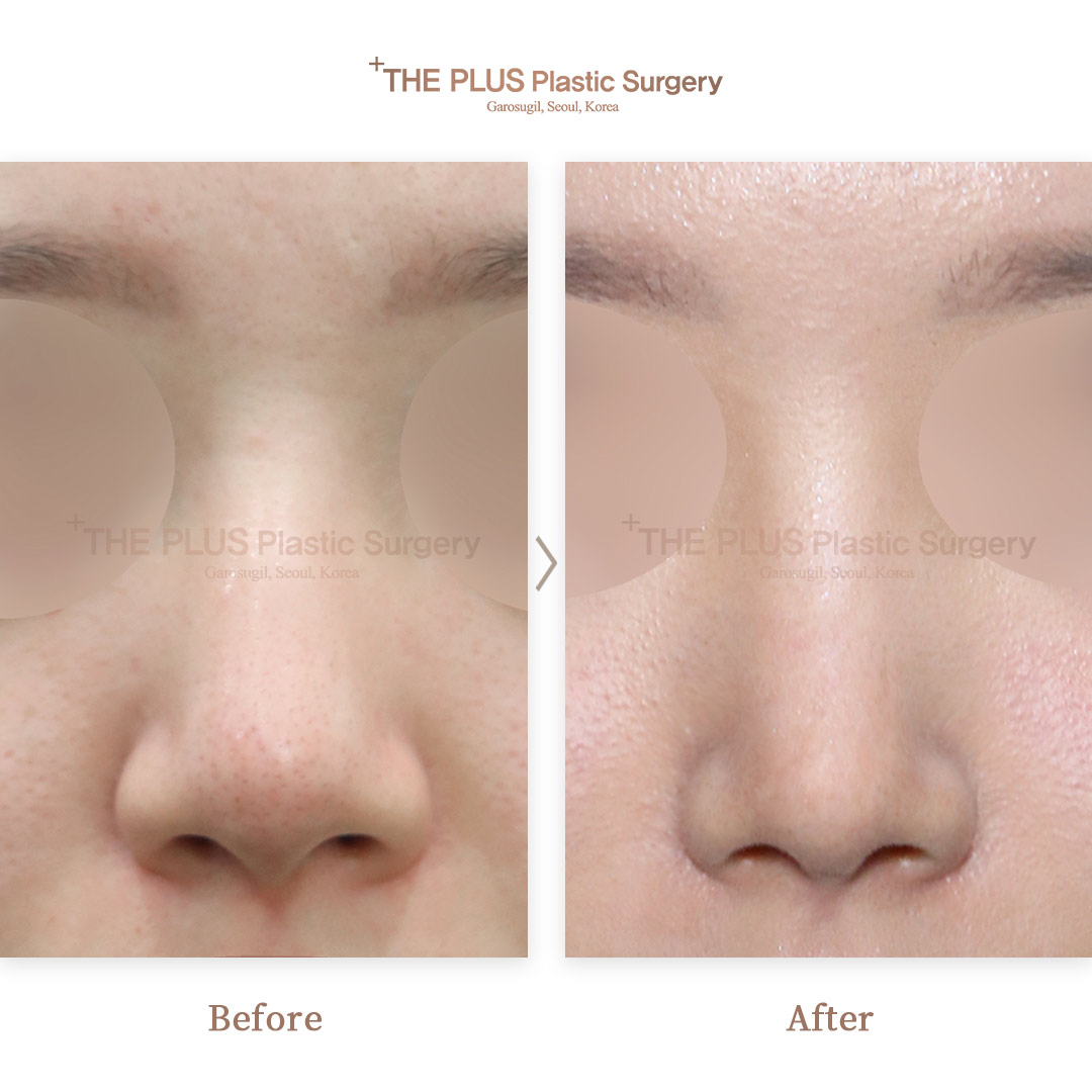 THE PLUS CLINIC KOREA -