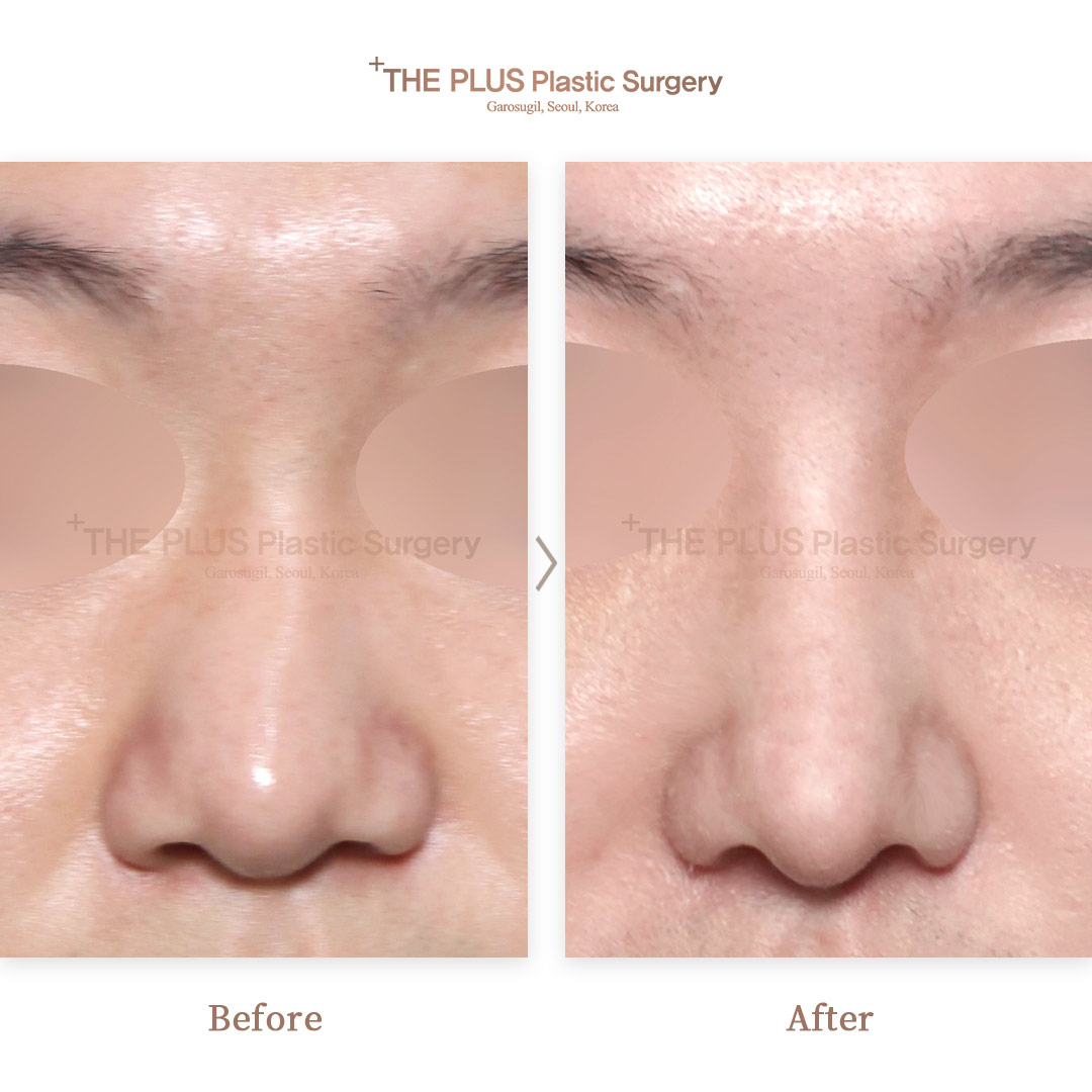 THE PLUS CLINIC KOREA -