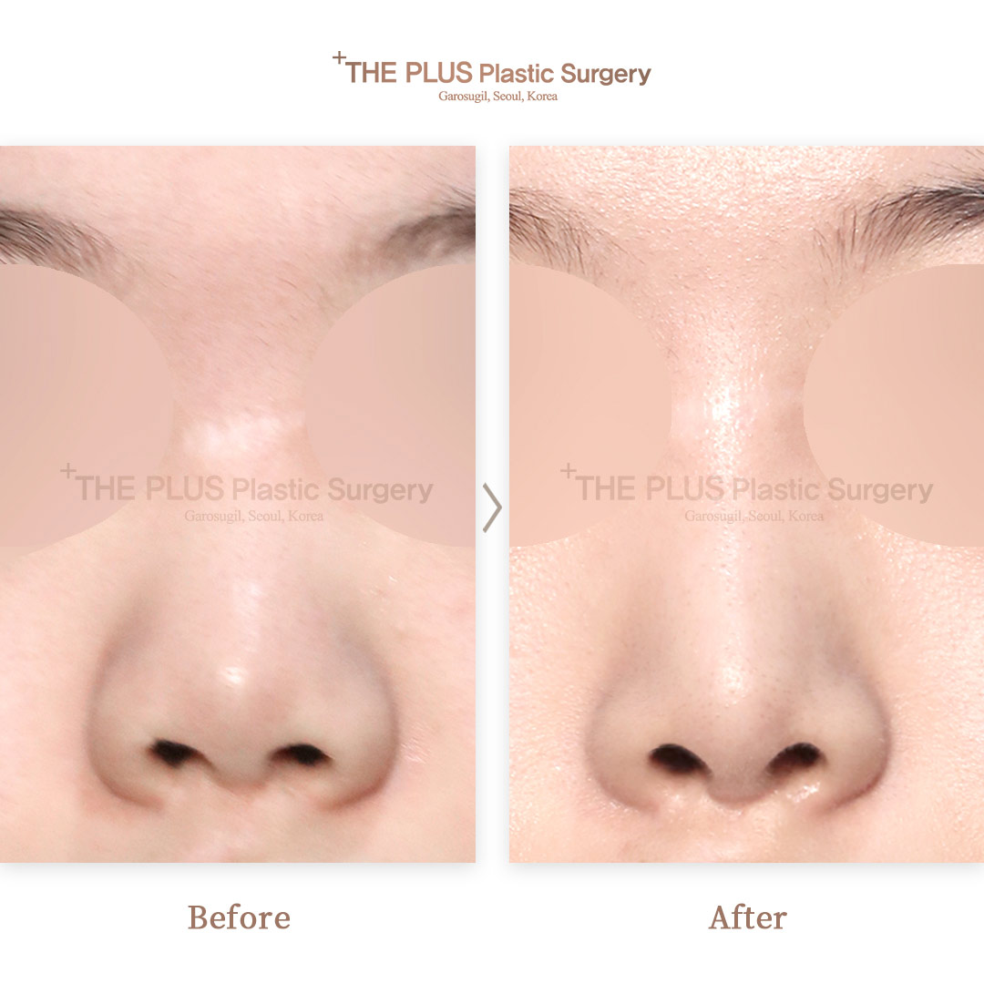 THE PLUS CLINIC KOREA -