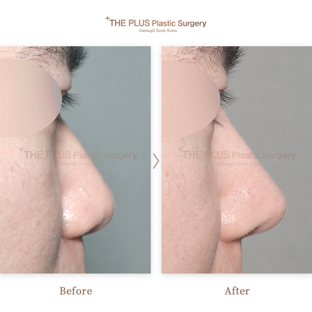 THE PLUS CLINIC KOREA -