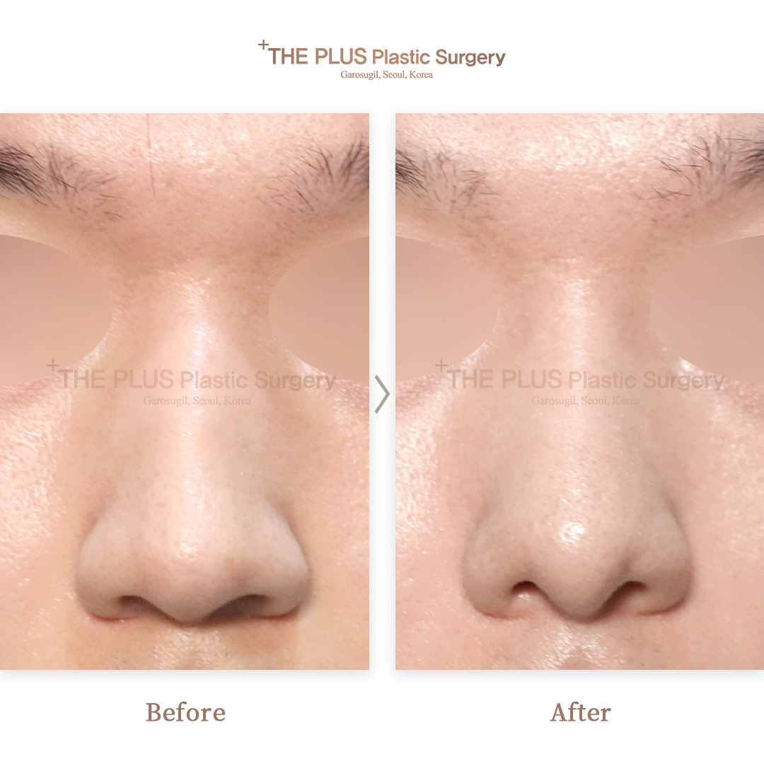 THE PLUS CLINIC KOREA -