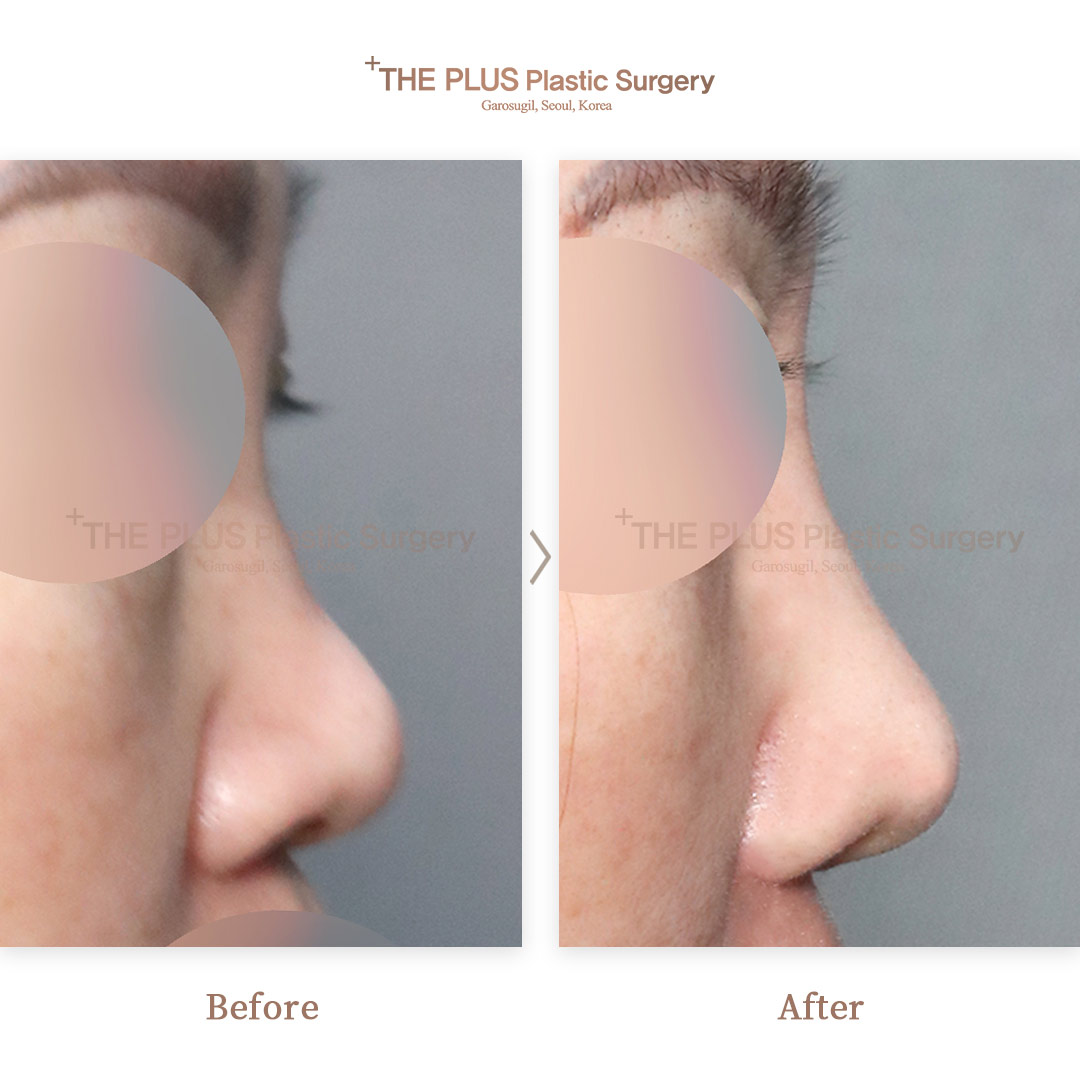 THE PLUS CLINIC KOREA -