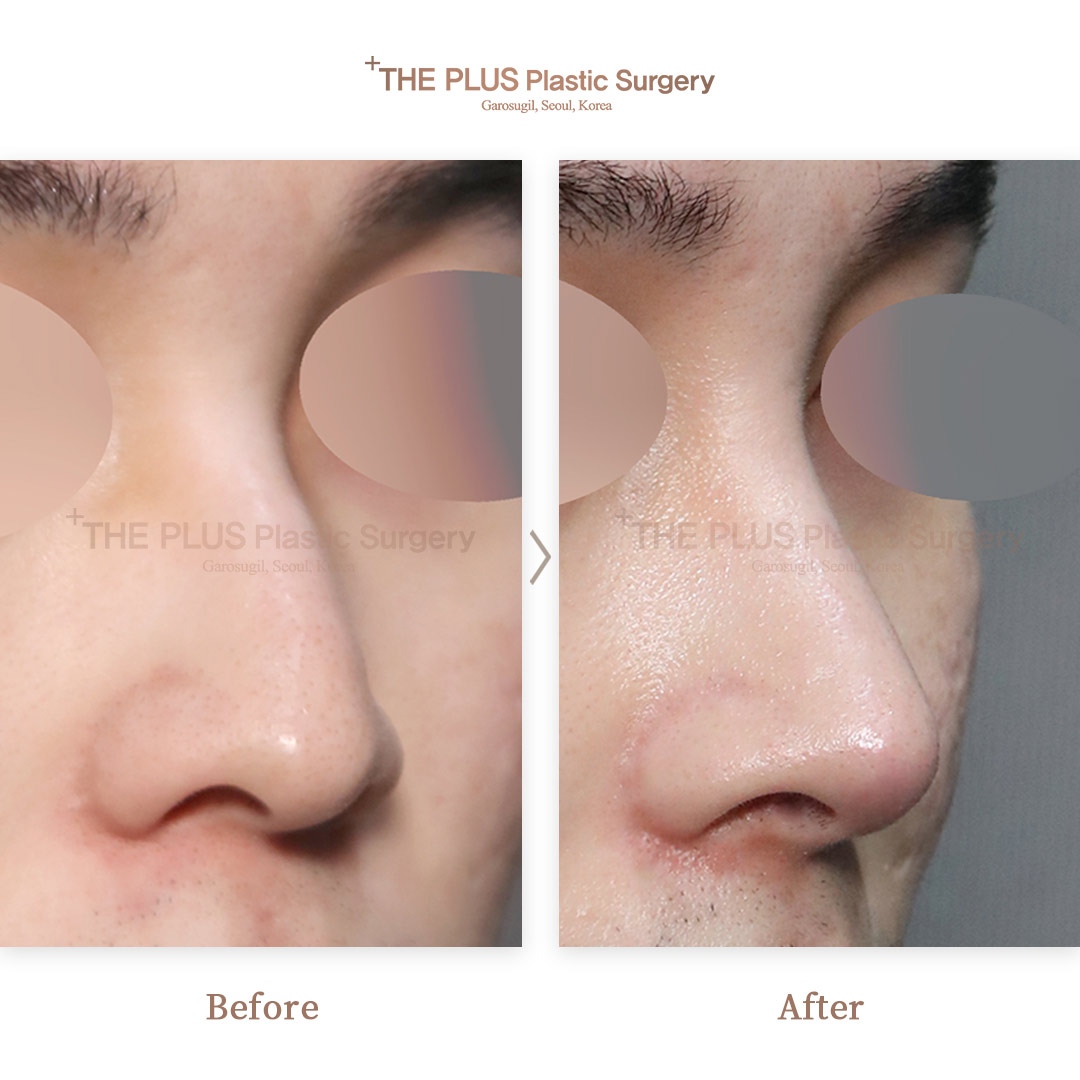 THE PLUS CLINIC KOREA -