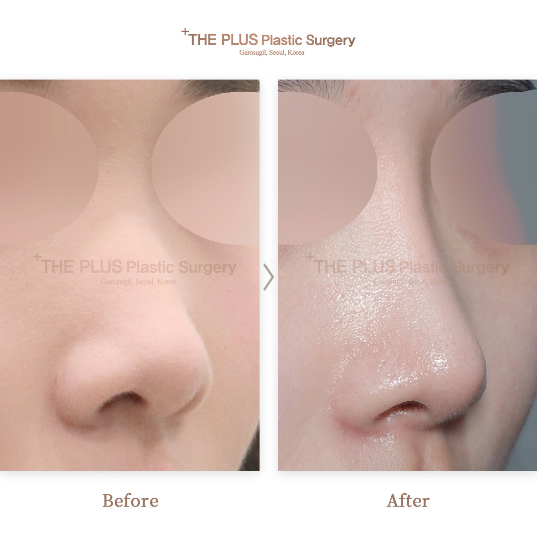 THE PLUS CLINIC KOREA -