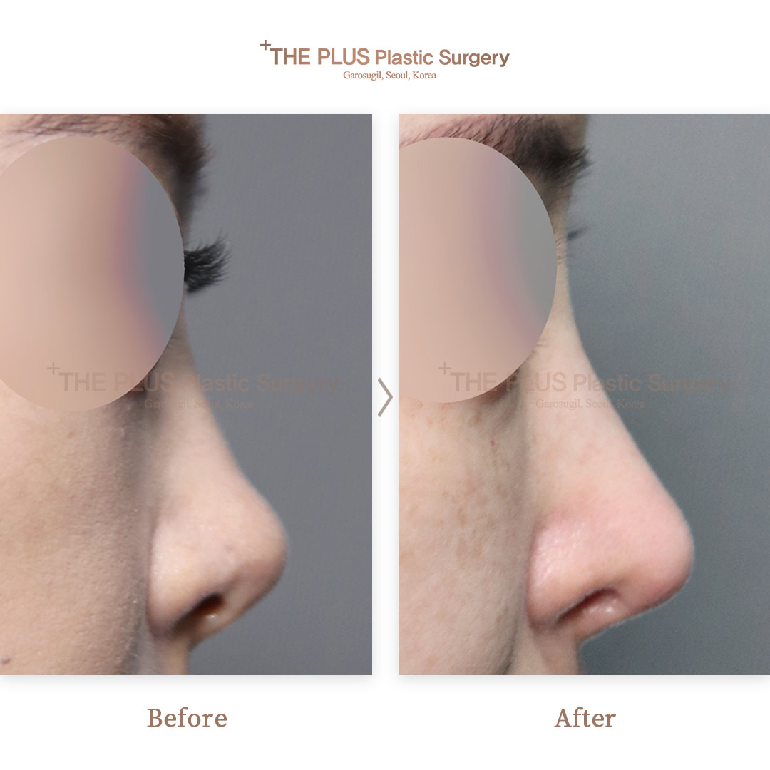 THE PLUS CLINIC KOREA -